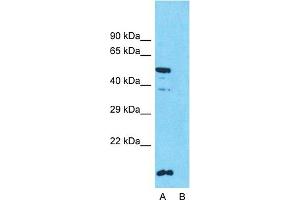 Host:  Rabbit  Target Name:  SLC10A1  Sample Type:  HT1080  Lane A:  Primary Antibody  Lane B:  Primary Antibody + Blocking Peptide  Primary Antibody Concentration:  1ug/ml  Peptide Concentration:  5ug/ml  Lysate Quantity:  25ug/lane/lane  Gel Concentration:  0. (SLC10A1 抗体  (Middle Region))