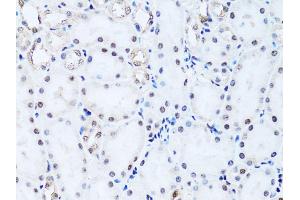 Immunohistochemistry of paraffin-embedded rat kidney using Histone H2B antibody (ABIN3015764, ABIN3015765, ABIN3015766 and ABIN6219109) at dilution of 1:100 (40x lens). (Histone H2B 抗体  (AA 1-126))