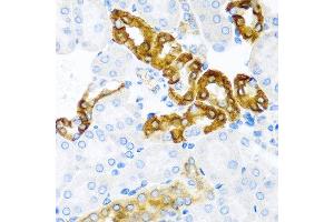 Immunohistochemistry of paraffin-embedded mouse kidney using CST1 antibody at dilution of 1:100 (40x lens). (CST1 抗体)