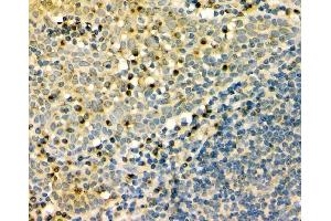 IHC analysis of GM130 using anti-GM130 antibody (ABIN6719432). (Golgin A2 (GOLGA2) (AA 796-913) 抗体)