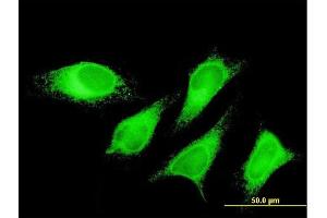 Immunofluorescence of monoclonal antibody to PTPLAD1 on HeLa cell. (PTPLAD1 抗体  (AA 1-113))