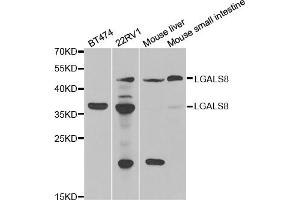 Western blot analysis of extracts of various cell lines, using LGALS8 antibody. (LGALS8 抗体)