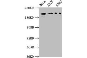 Western Blot Positive WB detected in: Hela whole cell lysate, A375 whole cell lysate, K562 whole cell lysate All lanes: PARD3 antibody at 3 μg/mL Secondary Goat polyclonal to rabbit IgG at 1/50000 dilution Predicted band size: 152, 142, 147, 139, 114, 109, 110, 150 kDa Observed band size: 152 kDa (PARD3 抗体  (AA 1068-1356))