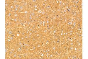 ABIN7094749 and ABIN7098800 at 1/100 staining Rat brain tissue by IHC-P. (BASP1 抗体  (N-Term))