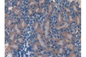 Detection of EIF3A in Mouse Kidney Tissue using Polyclonal Antibody to Eukaryotic Translation Initiation Factor 3A (EIF3A) (EIF6 抗体  (AA 622-848))