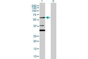 Western Blot analysis of CUGBP2 expression in transfected 293T cell line by CUGBP2 MaxPab polyclonal antibody. (CELF2 抗体  (AA 1-521))