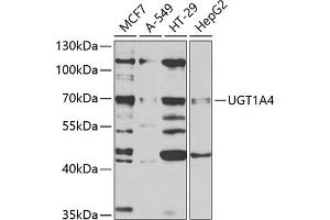 Western blot analysis of extracts of various cell lines, using UGT1 antibody (ABIN6132770, ABIN6149897, ABIN6149898 and ABIN6221194) at 1:1000 dilution. (UGT1A4 抗体  (AA 29-150))
