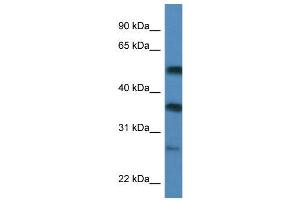 WB Suggested Anti-SERBP1  Antibody Titration: 0.
