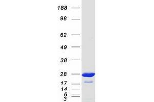 Validation with Western Blot