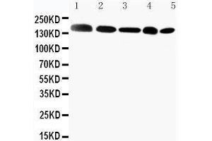 Anti-Gli2 antibody, Western blotting Lane 1: MCF-7 Cell Lysate Lane 2: HELA Cell Lysate Lane 3: SKOV Cell Lysate Lane 4:  Cell Lysate Lane 5: A549 Cell Lysate (GLI2 抗体  (C-Term))