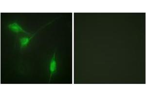 Immunofluorescence analysis of NIH-3T3 cells, using Akt (Phospho-Ser246) Antibody. (AKT1 抗体  (pSer246))