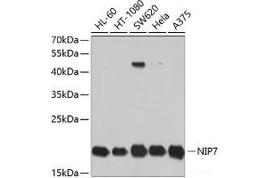 Western blot analysis of extracts of various cell lines using NIP7 Polyclonal Antibody at dilution of 1:1000. (NIP7 抗体)
