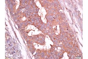Immunohistochemistry (Paraffin-embedded Sections) (IHC (p)) image for anti-Troponin T (Tn T) (AA 201-298) antibody (ABIN2179815)