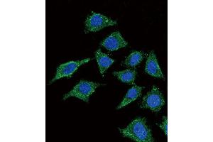 Confocal immunofluorescent analysis of LCAT Antibody (Center) (ABIN653825 and ABIN2843093) with 293 cell followed by Alexa Fluor? (LCAT 抗体  (AA 285-313))