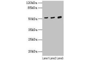Western blot All lanes: CDR2 antibody at 4 μg/mL Lane 1: Mouse lung tissue Lane 2: Hela whole cell lysate Lane 3: HepG2 whole cell lysate Secondary Goat polyclonal to rabbit IgG at 1/10000 dilution Predicted band size: 52 kDa Observed band size: 52 kDa (CDR2 抗体  (AA 1-454))