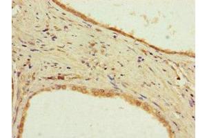 Immunohistochemistry (IHC) image for anti-Protein Phosphatase 2, Regulatory Subunit B, delta (PPP2R2D) (AA 1-192), (Regulatory Subunit B) antibody (ABIN7169250)