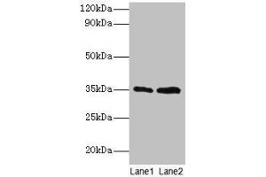 Western blot All lanes: GTF2B antibody at 2 μg/mL Lane 1: HepG2 whole cell lysate Lane 2: Hela whole cell lysate Secondary Goat polyclonal to rabbit IgG at 1/15000 dilution Predicted band size: 35 kDa Observed band size: 35 kDa (GTF2B 抗体  (AA 1-316))