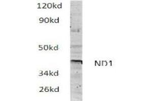 Image no. 1 for anti-Mitochondrially Encoded NADH Dehydrogenase 1 (MT-ND1) antibody (ABIN317922)