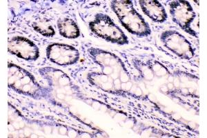 IHC analysis of HnRNPF using anti-HnRNPF antibody (ABIN4886622).