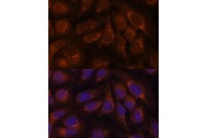 Immunofluorescence analysis of U-2 OS cells using CREB3 antibody (ABIN6128862, ABIN6139013, ABIN6139015 and ABIN6222241) at dilution of 1:100. (CREB3 抗体  (AA 1-230))