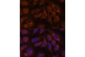 Immunofluorescence analysis of U-2 OS cells using CREB3 antibody (ABIN6128862, ABIN6139013, ABIN6139015 and ABIN6222241) at dilution of 1:100. (CREB3 抗体  (AA 1-230))