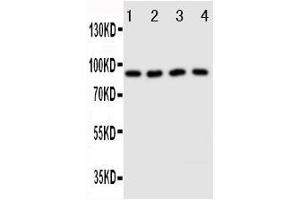 Anti-Cullin3 antibody, Western blotting Lane 1: HELA Cell Lysate Lane 2: MCF-7 Cell Lysate Lane 3: Rat Testis Tissue Lysate Lane 4: Rat Brain Tissue Lysate (Cullin 3 抗体  (Middle Region))