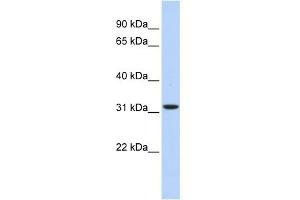WB Suggested Anti-HIBADH Antibody Titration: 0. (HIBADH 抗体  (Middle Region))