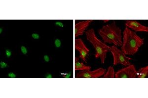 Immunofluorescence (IF) image for anti-Proliferating Cell Nuclear Antigen (PCNA) antibody (ABIN2854788)
