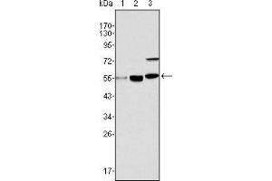 Western blot analysis using MYST1 mouse mAb against Hela (1), HepG2 (2) and SMMC-7721 (3) cell lysate. (MYST1 抗体)