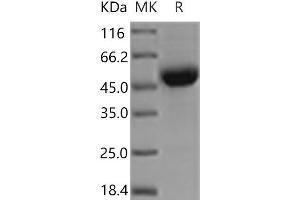 Western Blotting (WB) image for CD79b Molecule, Immunoglobulin-Associated beta (CD79B) protein (Fc Tag) (ABIN7321126) (CD79b Protein (Fc Tag))