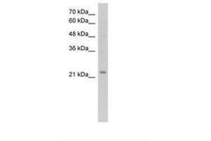 Image no. 2 for anti-Epithelial Membrane Protein 2 (EMP2) (C-Term) antibody (ABIN203481) (EMP2 抗体  (C-Term))