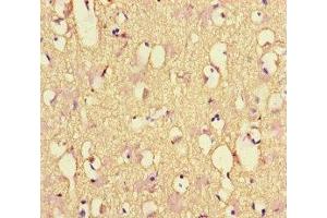 Immunohistochemistry of paraffin-embedded human brain tissue using ABIN7161278 at dilution of 1:100 (NEFL 抗体  (AA 128-271))