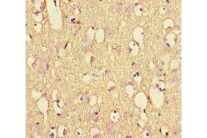 Immunohistochemistry of paraffin-embedded human brain tissue using ABIN7161278 at dilution of 1:100 (NEFL 抗体  (AA 128-271))