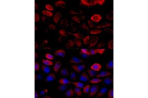 Immunofluorescence analysis of HeLa cells using FGFR2 antibody (ABIN6130457, ABIN6140615, ABIN6140617 and ABIN6216059) at dilution of 1:100 (40x lens). (FGFR2 抗体  (AA 245-345))