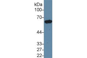 Western Blot; Sample: Rat Ovary lysate; Primary Ab: 1µg/ml Rabbit Anti-Rat KRT5 Antibody Second Ab: 0. (Cytokeratin 5 抗体  (AA 335-473))