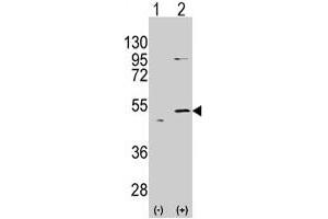 Western blot analysis of ALDH5A1 (arrow) using rabbit ALDH5A1 polyclonal antibody . (ALDH5A1 抗体  (N-Term))