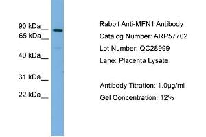 WB Suggested Anti-MFN1  Antibody Titration: 0. (MFN1 抗体  (Middle Region))