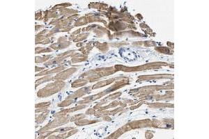 Immunohistochemical staining of human heart muscle with HHATL polyclonal antibody  shows moderate cytoplasmic positivity in myocytes at 1:10-1:20 dilution. (HHATL 抗体)