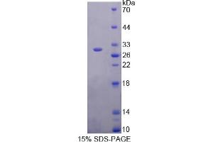 Image no. 1 for Inhibitory Subunit of NF kappa B delta (IkBd) (AA 58-304) protein (His tag) (ABIN6238071)