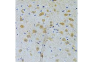 Immunohistochemistry of paraffin-embedded rat brain using CHIA Antibody (ABIN5973937) at dilution of 1/100 (40x lens). (CHIA 抗体)