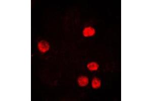 Immunofluorescent analysis of PCNA staining in HeLa cells. (PCNA 抗体  (Center))