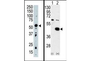 (LEFT) Western blot analysis of PDK2 Antibody (C-term) in mouse intestine tissue lysate (35ug/lane). (PDK2 抗体  (C-Term))
