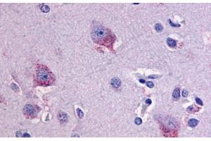 Anti-LPHN1 antibody  ABIN1049023 IHC staining of human brain, neurons and glia. (Latrophilin 1 抗体  (C-Term))