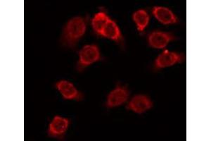ABIN6274153 staining Hela by IF/ICC. (HEXB 抗体  (C-Term))