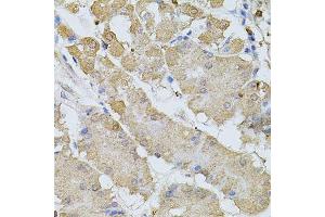 Immunohistochemistry of paraffin-embedded human stomach using BEST1 antibody. (Bestrophin 1 抗体  (AA 200-300))