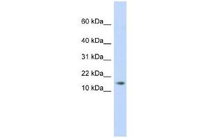 C11ORF67 antibody used at 1 ug/ml to detect target protein. (AAMDC 抗体  (Middle Region))