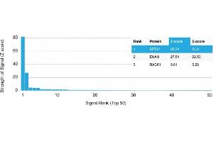 Analysis of Protein Array containing more than 19,000 full-length human proteins using Spectrin, alpha 1 Mouse Monoclonal Antibody (SPTA1/1810) Z- and S- Score: The Z-score represents the strength of a signal that a monoclonal antibody (MAb) (in combination with a fluorescently-tagged anti-IgG secondary antibody) produces when binding to a particular protein on the HuProtTM array. (SPTA1 抗体  (AA 356-475))