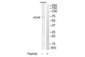 Western blot analysis of extracts from HepG2 cells, using ACHE antibody. (Acetylcholinesterase 抗体  (C-Term))