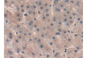 Detection of Sp100 in Human Liver Tissue using Polyclonal Antibody to Sp100 Nuclear Antigen (Sp100) (SP100 抗体  (AA 610-802))