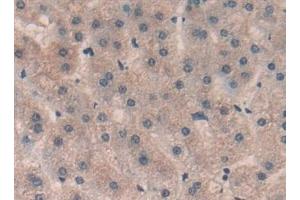 Detection of Sp100 in Human Liver Tissue using Polyclonal Antibody to Sp100 Nuclear Antigen (Sp100)
